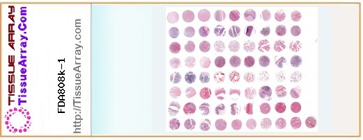 TissueArray.Com Tissue Array FDA808k-1