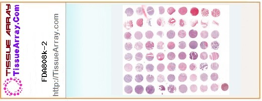 TissueArray.Com Tissue Array FDA808k-2