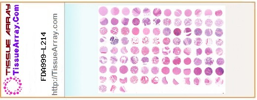 TissueArray.Com Tissue Array FDA999-L214