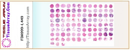 TissueArray.Com Tissue Array FDA999-L449