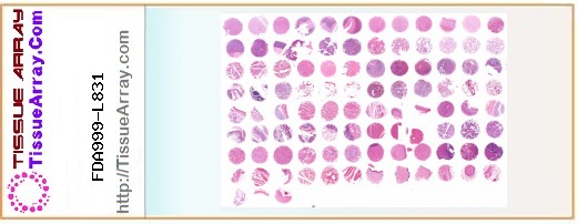 TissueArray.Com Tissue Array FDA999-L831