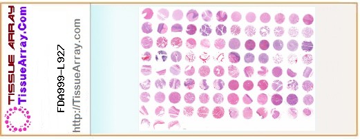 TissueArray.Com Tissue Array FDA999-L927