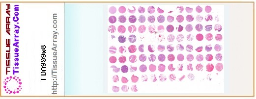 TissueArray.Com Tissue Array FDA999w8