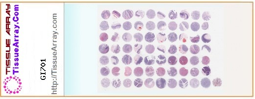 TissueArray.Com Tissue Array GI701