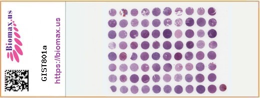TissueArray.Com Tissue Array GIST801a