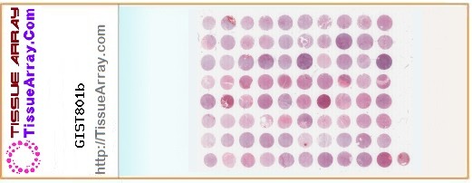 TissueArray.Com Tissue Array GIST801b
