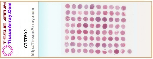 TissueArray.Com Tissue Array GIST802