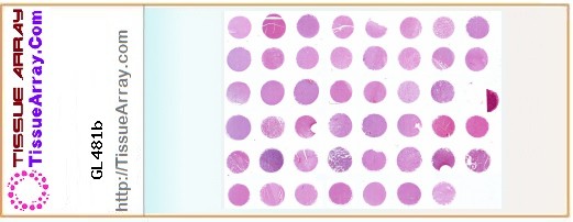 TissueArray.Com Tissue Array GL481b