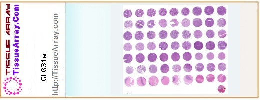 TissueArray.Com Tissue Array GL631a