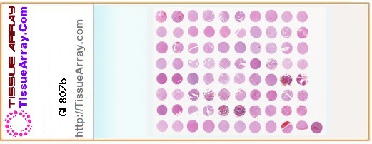 TissueArray.Com Tissue Array GL807b