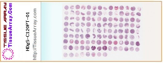TissueArray.Com Tissue Array HDgS-C120PT-01