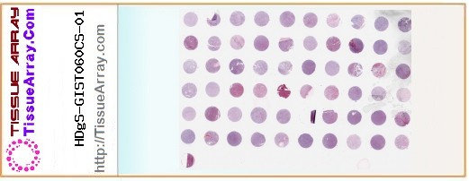 TissueArray.Com Tissue Array HDgS-GIST060CS-01