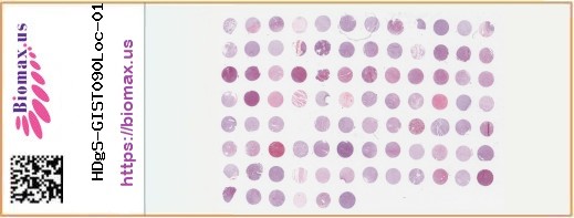 TissueArray.Com Tissue Array HDgS-GIST090Loc-01