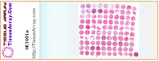 TissueArray.Com Tissue Array HE1001a