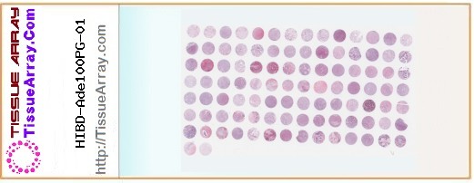 TissueArray.Com Tissue Array HIBD-Ade100PG-01