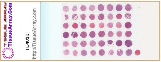 TissueArray.Com Tissue Array HL481b