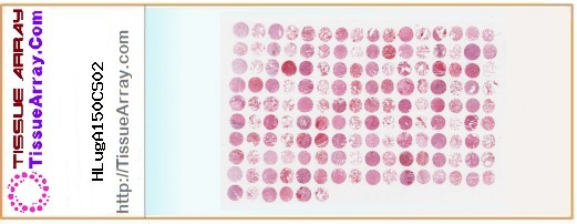 TissueArray.Com Tissue Array HLugA150CS02