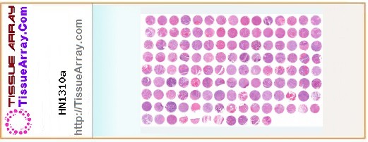 TissueArray.Com Tissue Array HN1310a