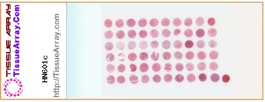 TissueArray.Com Tissue Array HN601c