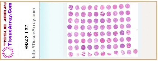 TissueArray.Com Tissue Array HN802-L67