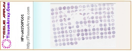 TissueArray.Com Tissue Array HProA150PG01