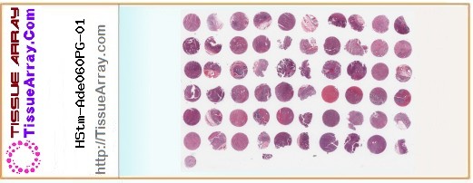 TissueArray.Com Tissue Array HStm-Ade060PG-01
