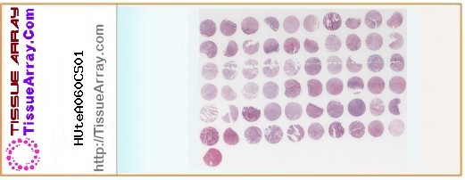 TissueArray.Com Tissue Array HUteA060CS01