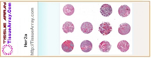 TissueArray.Com Tissue Array Her2a