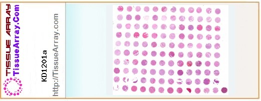 TissueArray.Com Tissue Array KD1201a