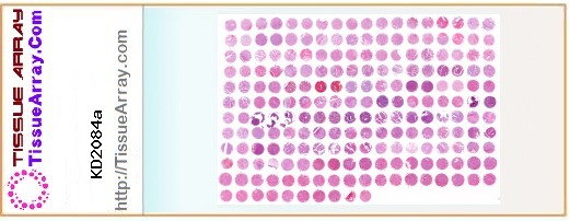 TissueArray.Com Tissue Array KD2084a