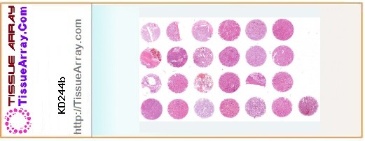 TissueArray.Com Tissue Array KD244b