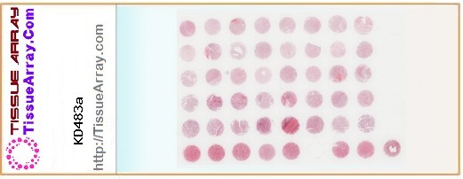 TissueArray.Com Tissue Array KD483a