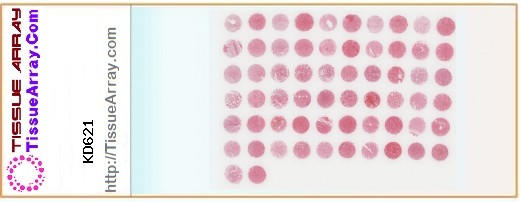 TissueArray.Com Tissue Array KD621