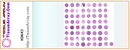 TissueArray.Com Tissue Array KD643