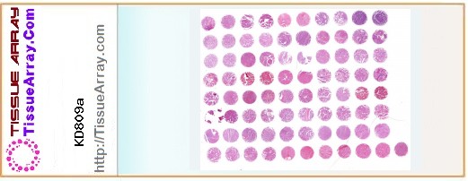 TissueArray.Com Tissue Array KD809a