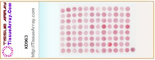 TissueArray.Com Tissue Array KD963