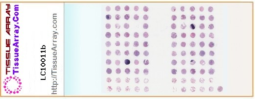 TissueArray.Com Tissue Array LC10011b