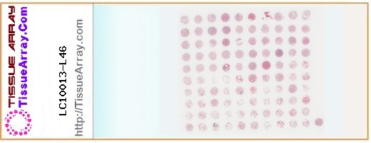 TissueArray.Com Tissue Array LC10013-L46