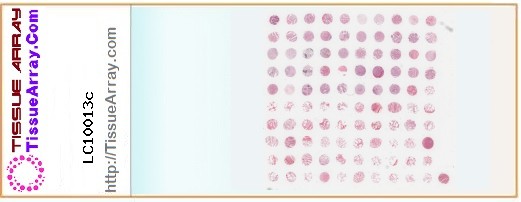 TissueArray.Com Tissue Array LC10013c