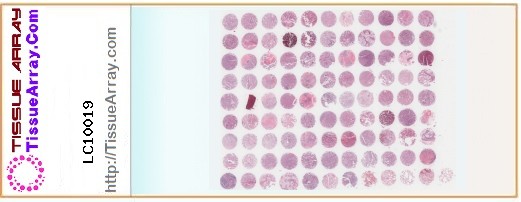 TissueArray.Com Tissue Array LC10019
