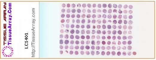 TissueArray.Com Tissue Array LC1401