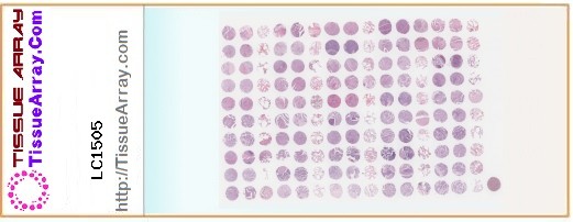 TissueArray.Com Tissue Array LC1505