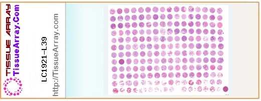 TissueArray.Com Tissue Array LC1921-L39