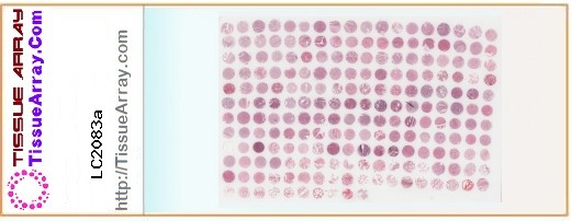 TissueArray.Com Tissue Array LC2083a
