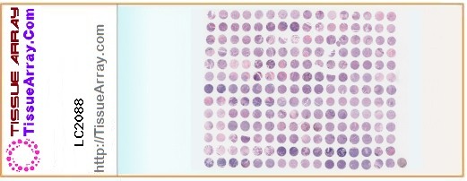 TissueArray.Com Tissue Array LC2088