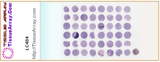 TissueArray.Com Tissue Array LC484