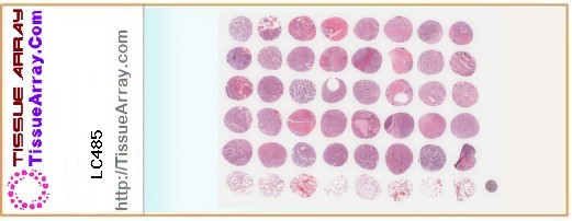 TissueArray.Com Tissue Array LC485