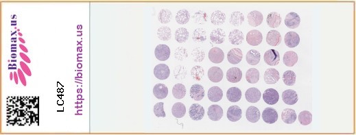 TissueArray.Com Tissue Array LC487