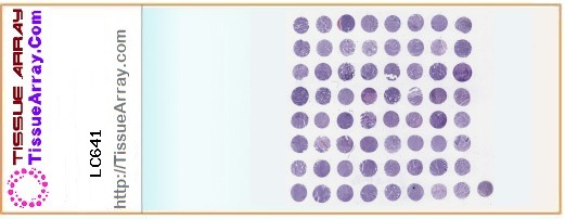 TissueArray.Com Tissue Array LC641