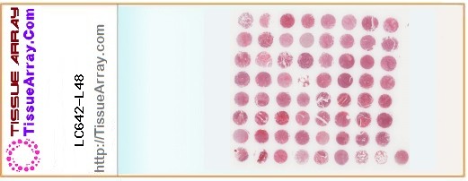 TissueArray.Com Tissue Array LC642-L48